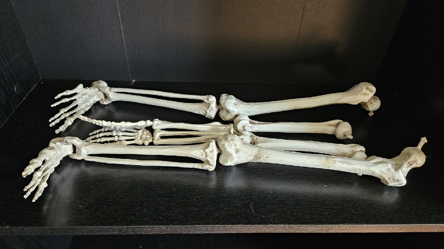 Skelly arms and legs