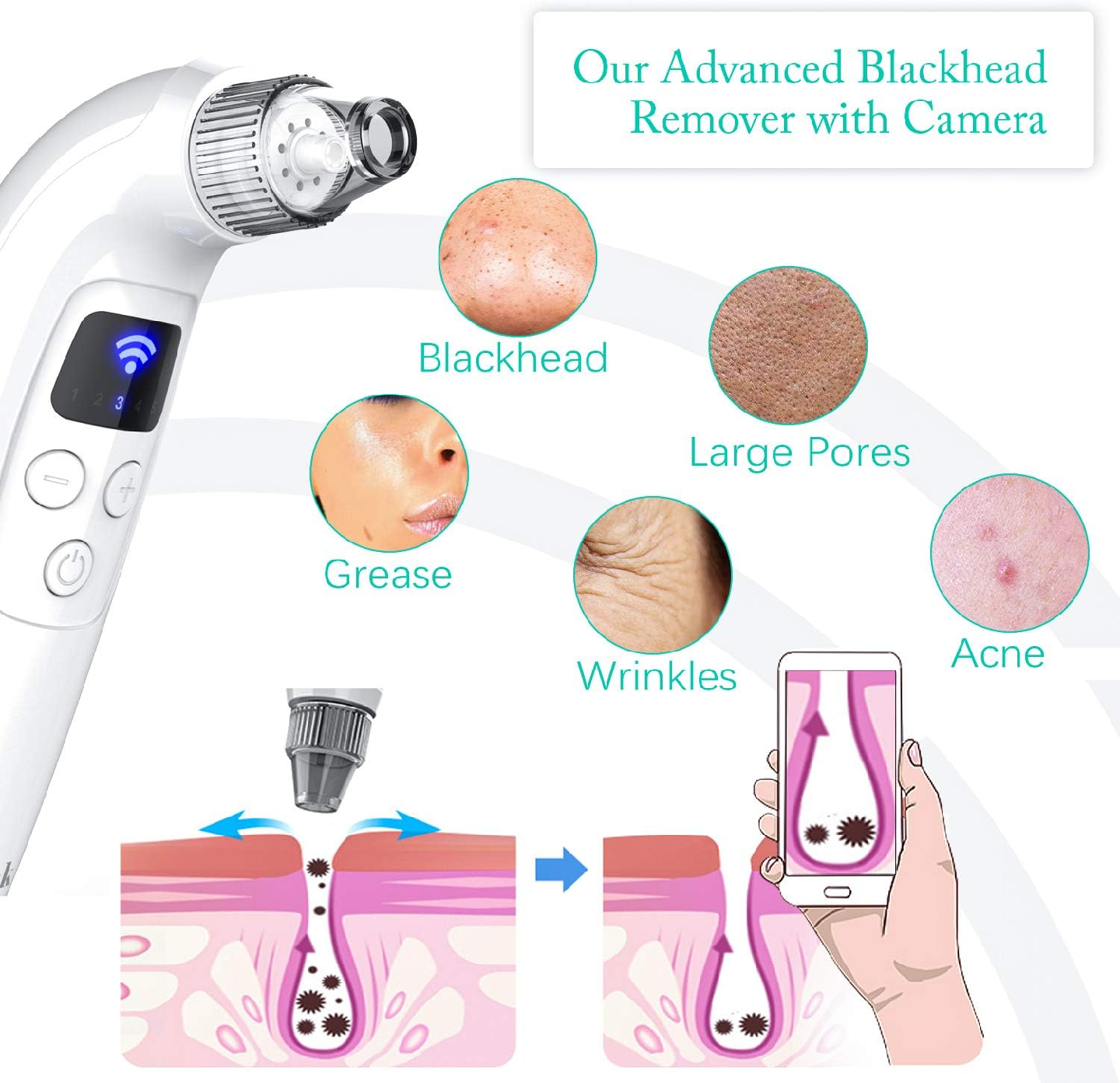 Oiiwak 5MP Visible Blackhead Vacuum, Blackhead Remover - photo 5