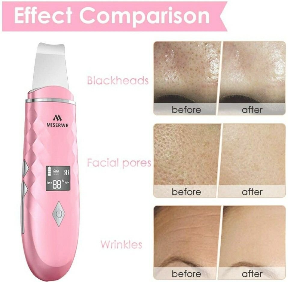 Skin Scrubber with LCD Display Skin Spatula Pore Cleaner - photo 4