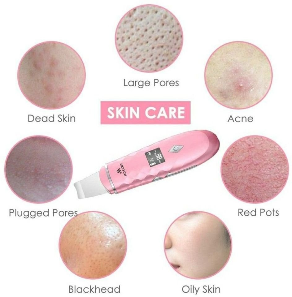 Skin Scrubber with LCD Display Skin Spatula Pore Cleaner - photo 5