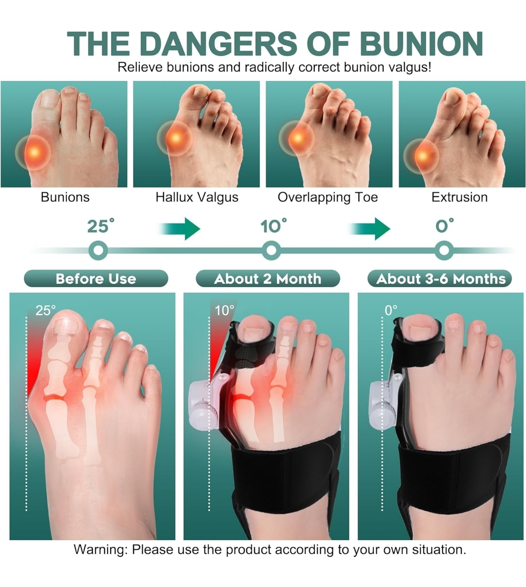 New Simpilos Bunion Corrector, Black - photo 3