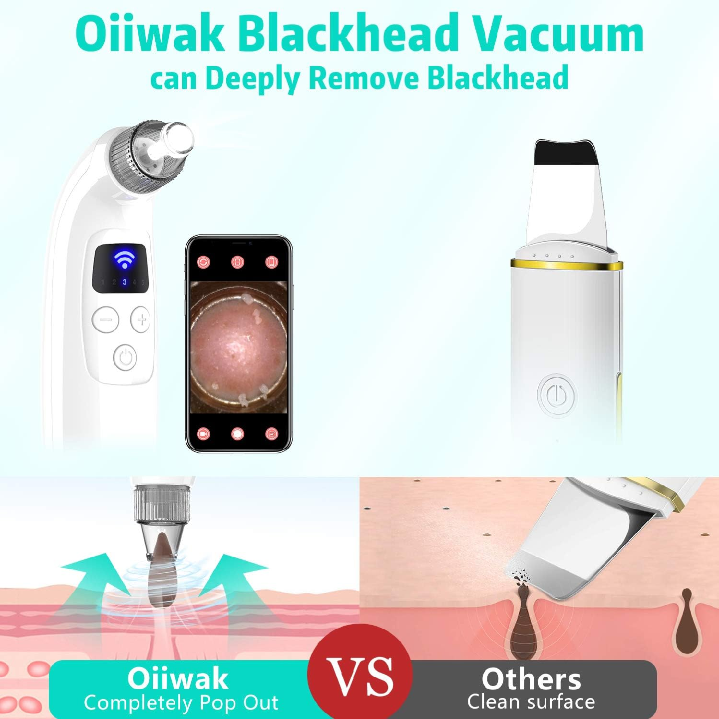 Oiiwak 5MP Visible Blackhead Vacuum, Blackhead Remover - photo 3