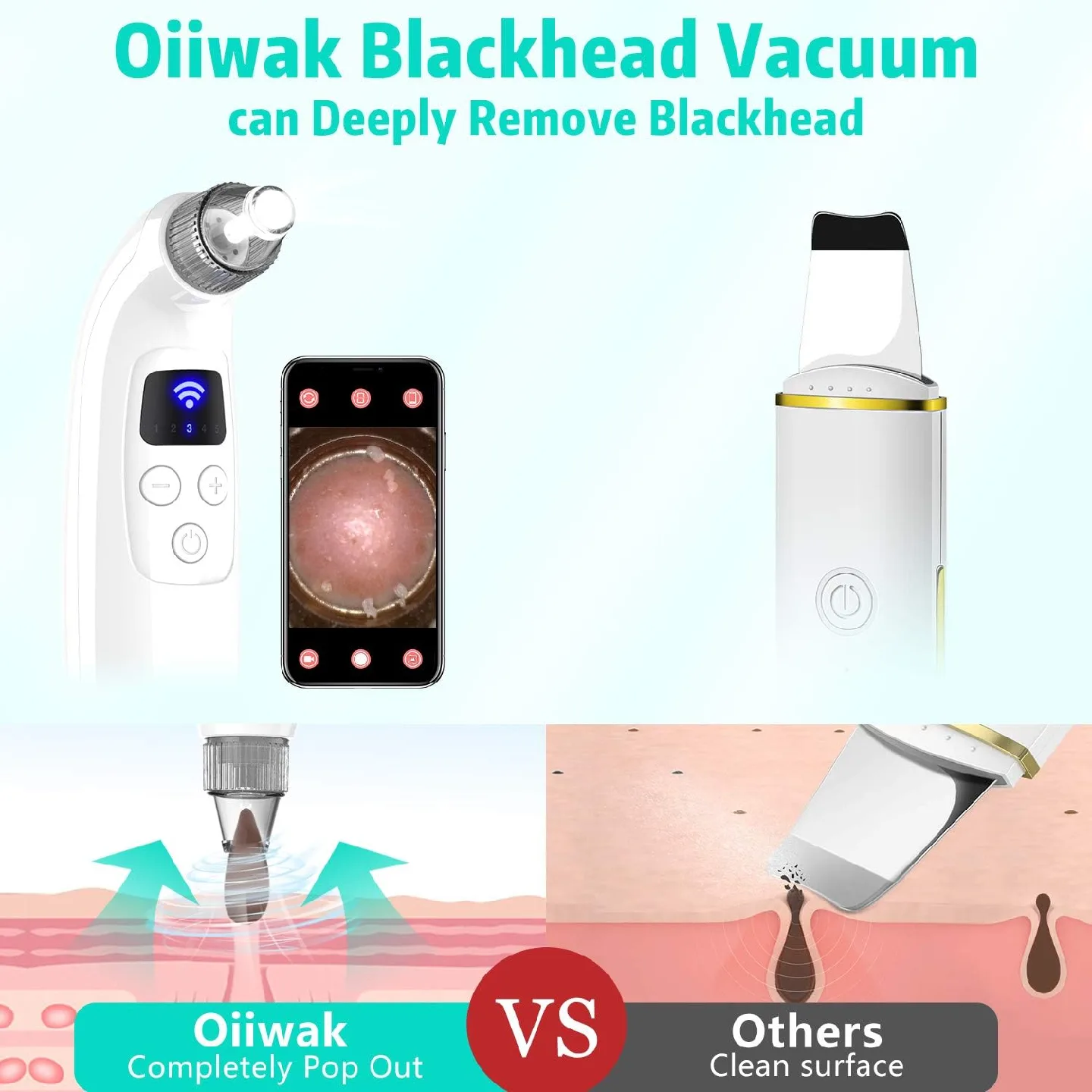 Oiiwak 5MP Visible Blackhead Vacuum, Blackhead Remover image indicator(3)