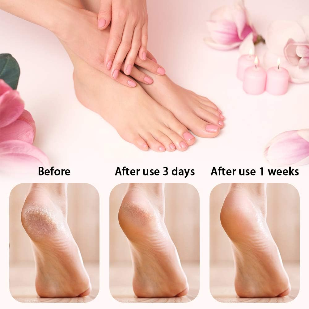 Callus Remover with LED Display Cordless Rechargeable - photo 4