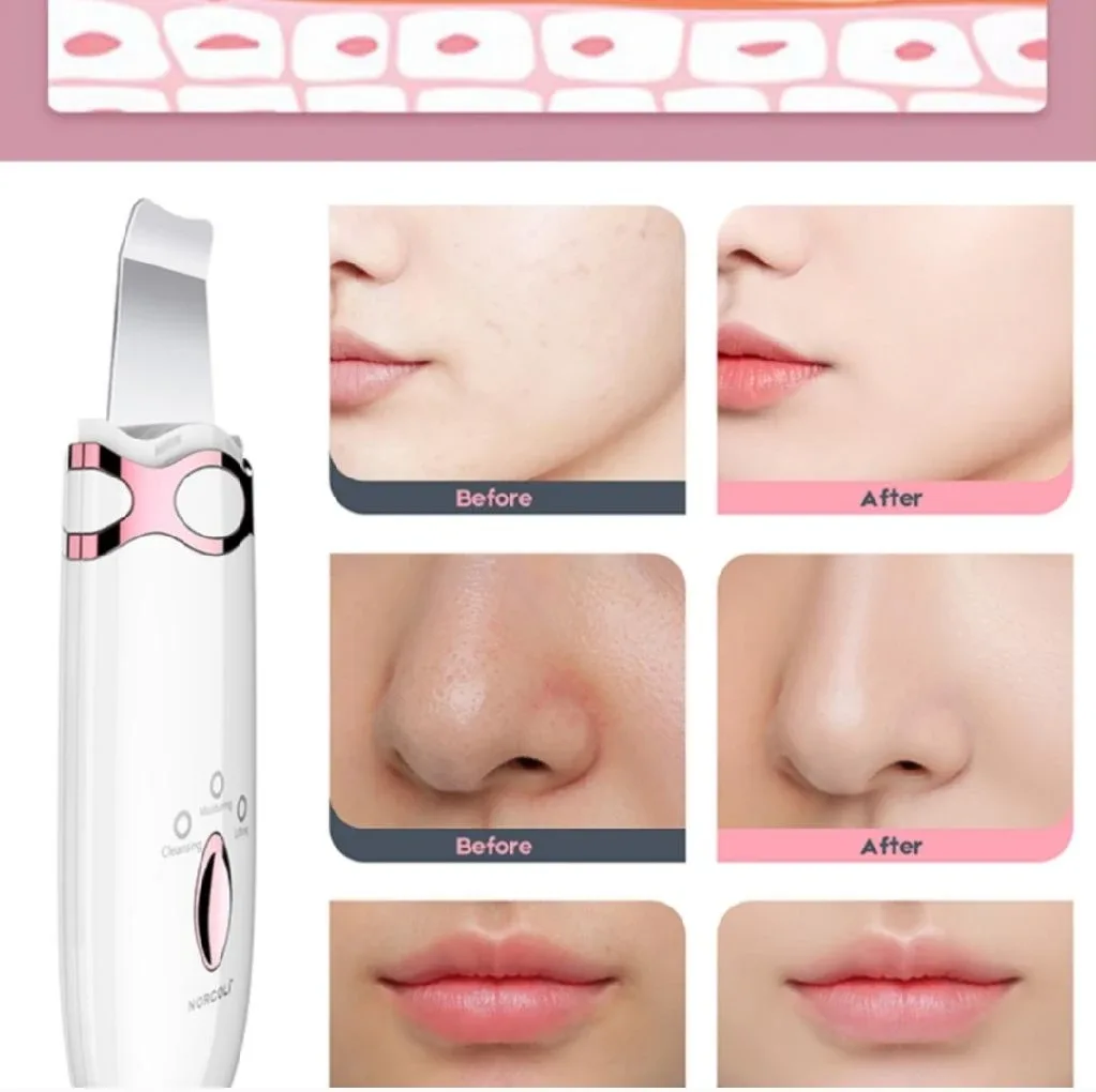 NORCOLT Facial Skin Scrubber | 3-in-1 Exfoliating Wand image indicator(2)
