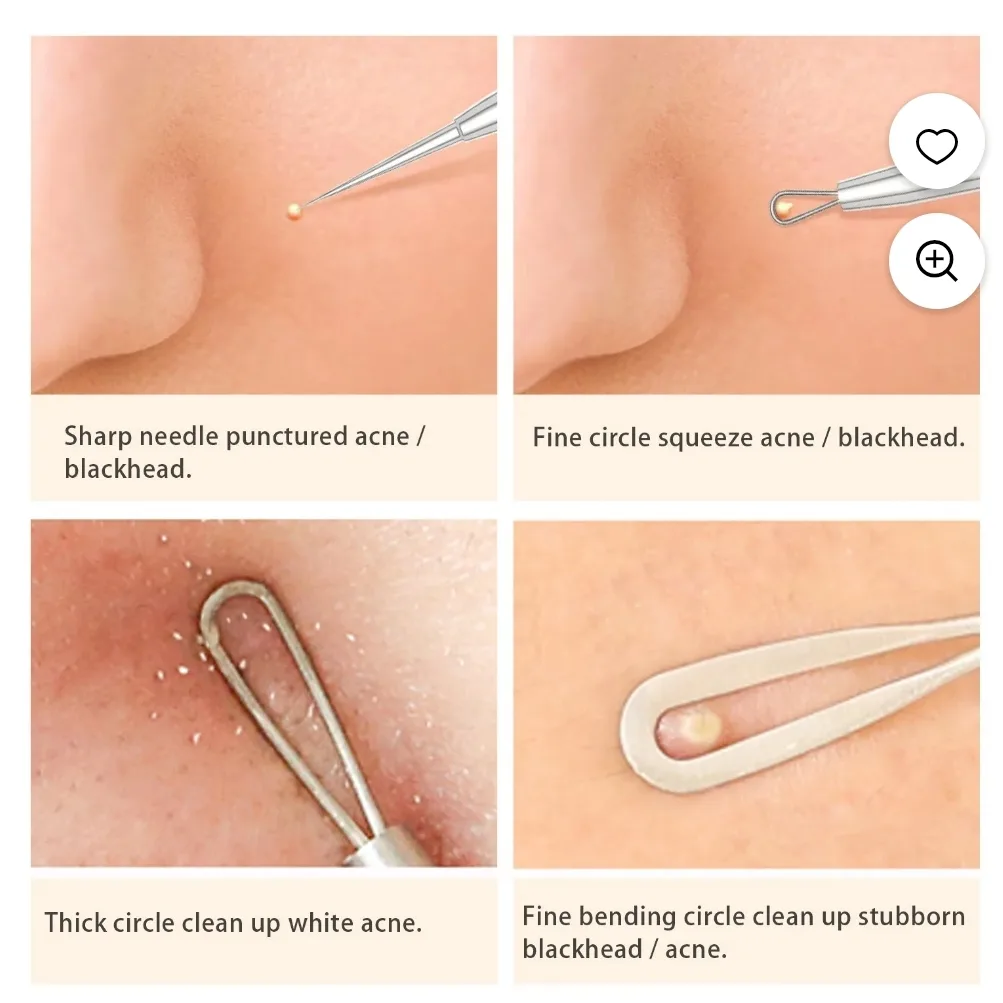 BESTOPE Blackhead Remover Kit image indicator(2)