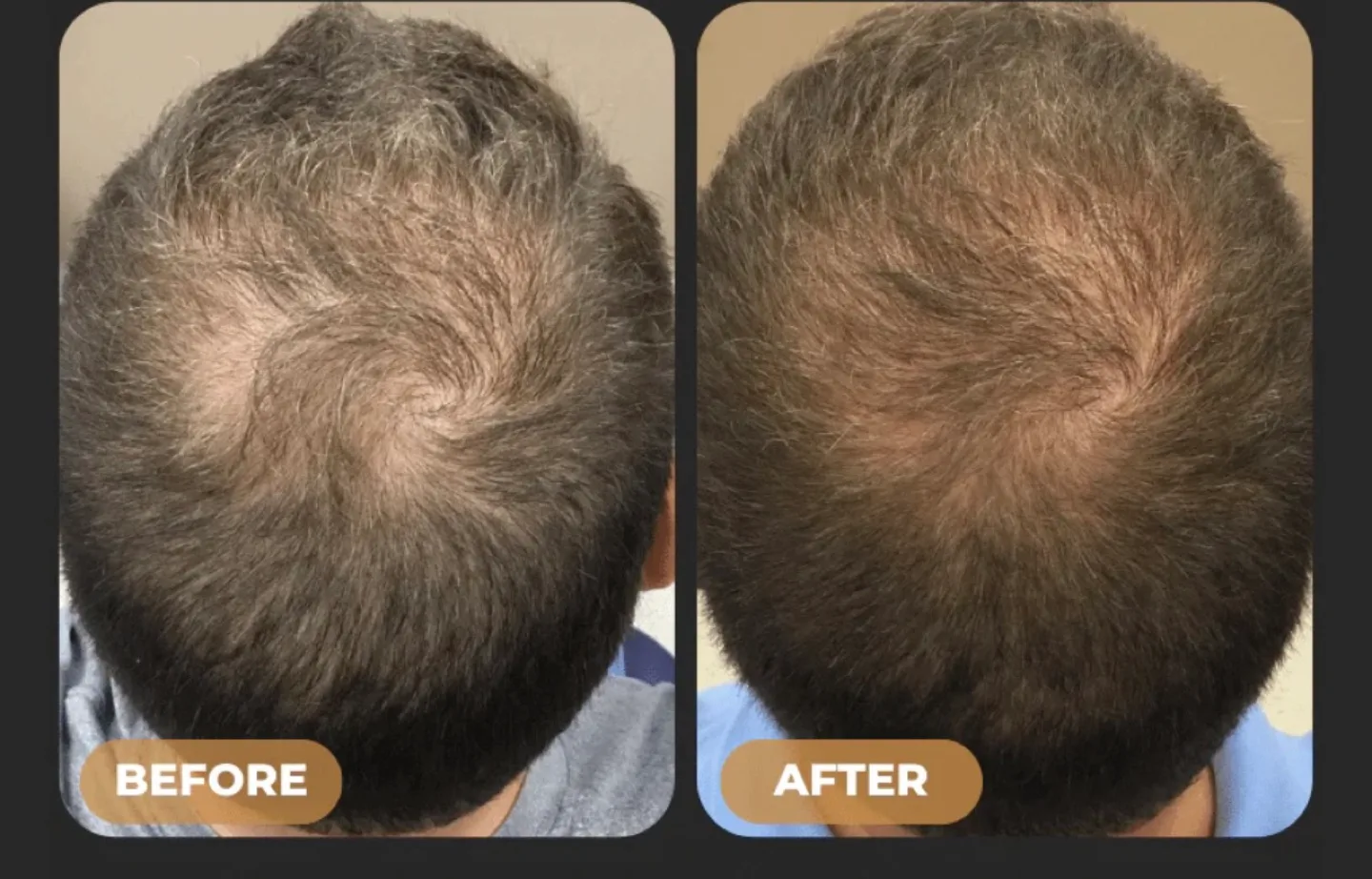 New Spartan Root Activator Shampoo 200ml image indicator(5)