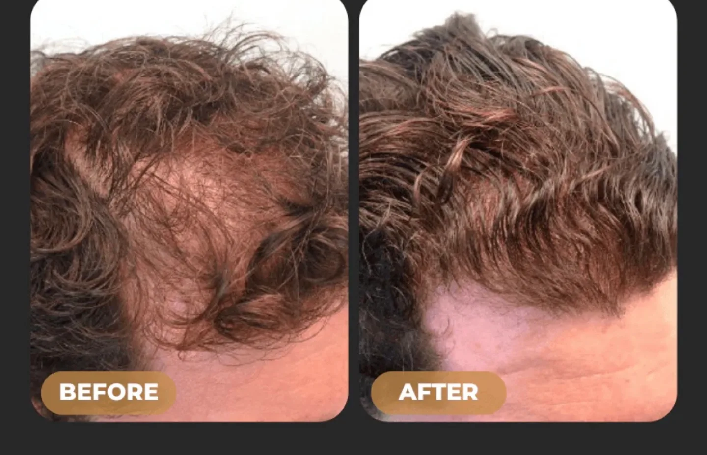 New Spartan Root Activator Shampoo 200ml image indicator(4)