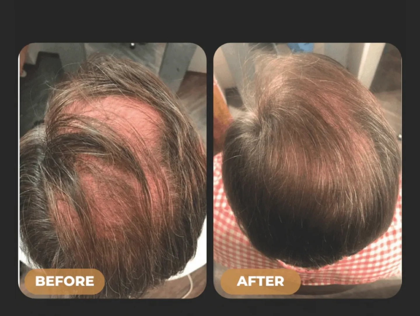 New Spartan Root Activator Shampoo 200ml image indicator(6)