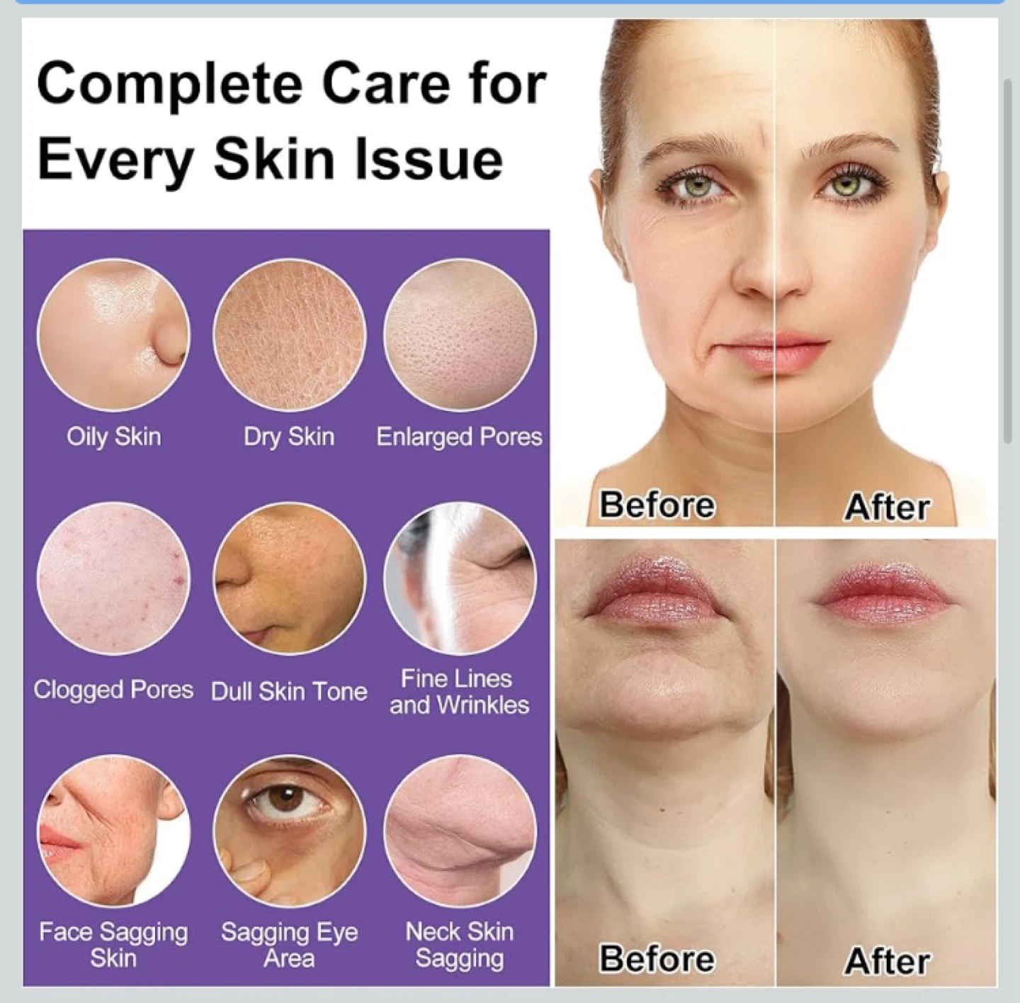 Moisturizing & Tightening Skincare Set - photo 2