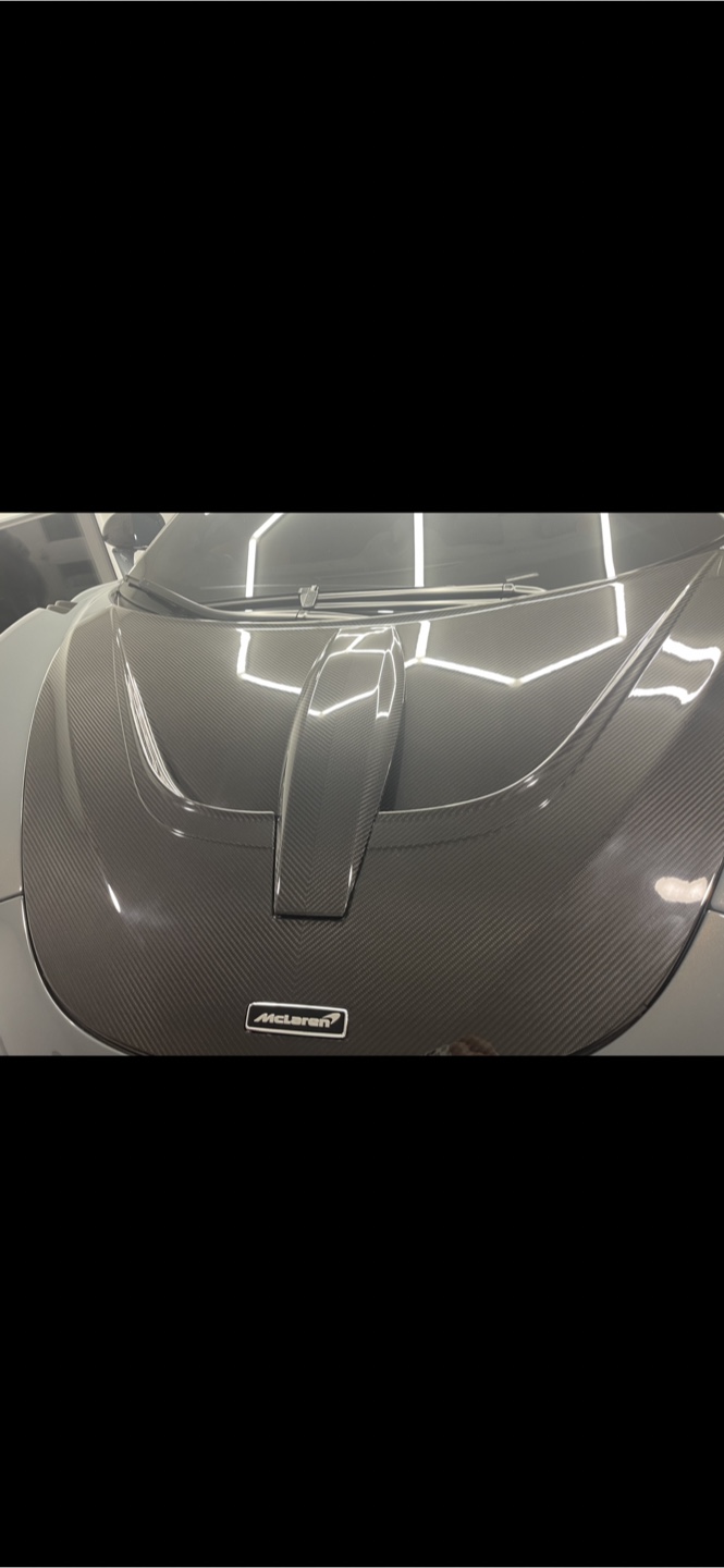 Carbon Fiber Front Engine Hood  - McLaren 720S 750 - photo 3
