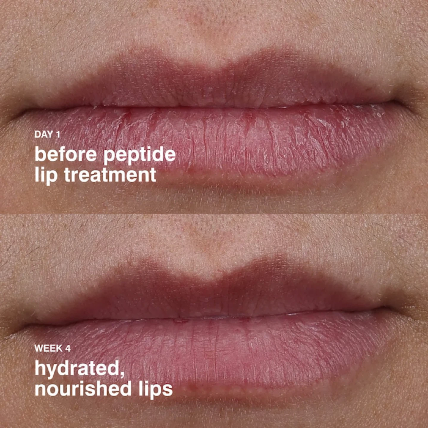 Rhode Peptide Lip Treatment - Vanilla - photo 4