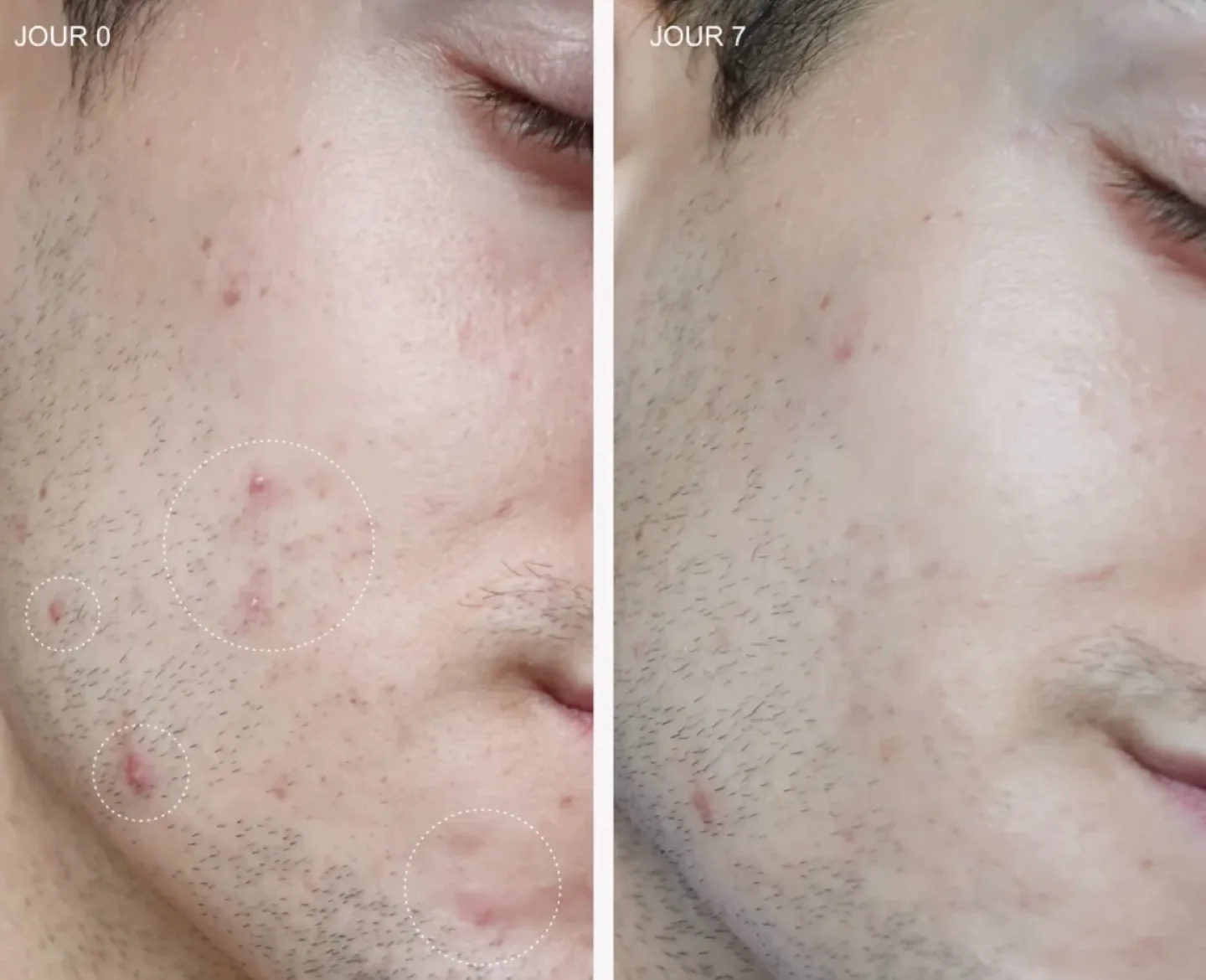 OMY Laboratoires 360 Spot Clearing Gel image indicator(5)