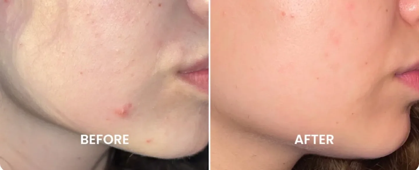 Flutterhabit Hype Girl Hypochlorous Acid Spray (New) image indicator(3)