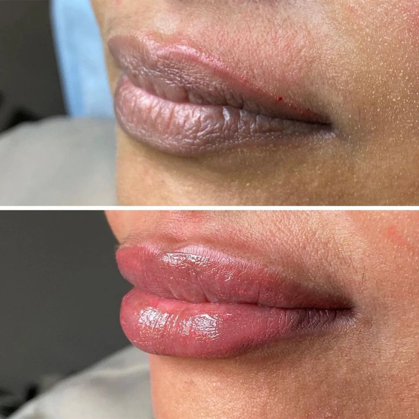 Lip-blush#pmu#lip-neutralization image indicator(2)