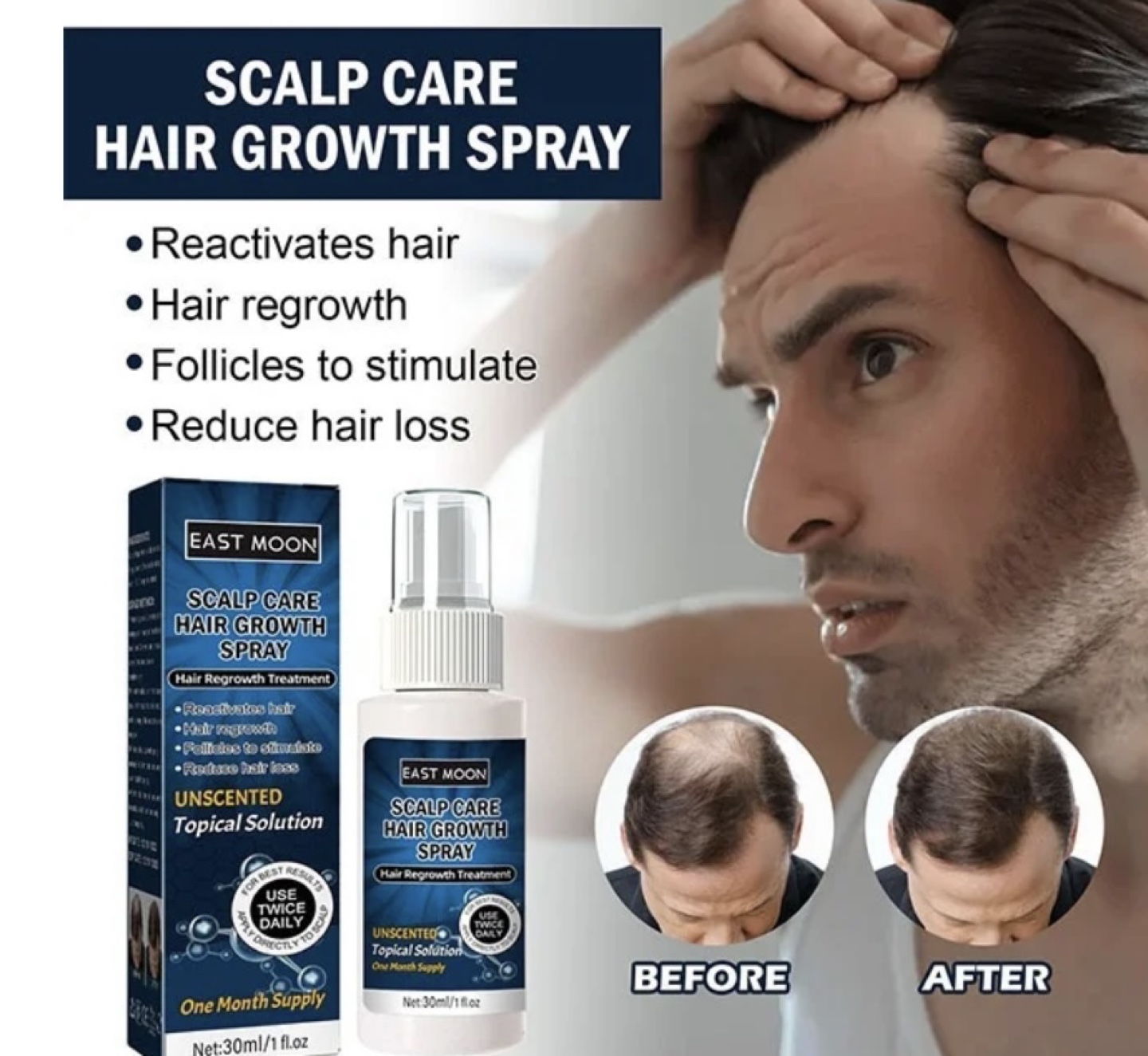 East Moon Scalp Care Hair Growth Spray - photo 5