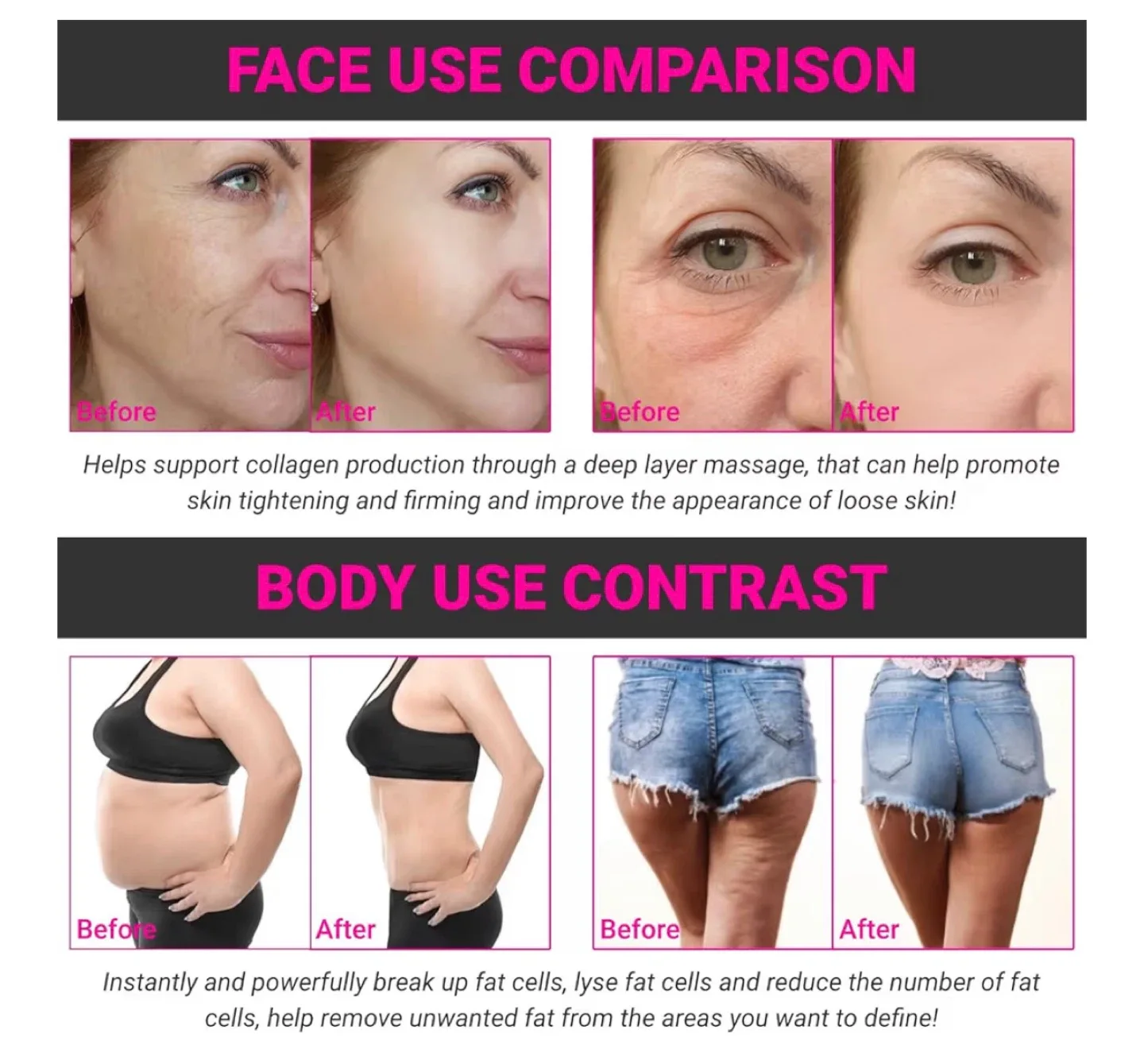 Radiofrequency 40K Cavitation Body Slimming Machine image indicator(6)