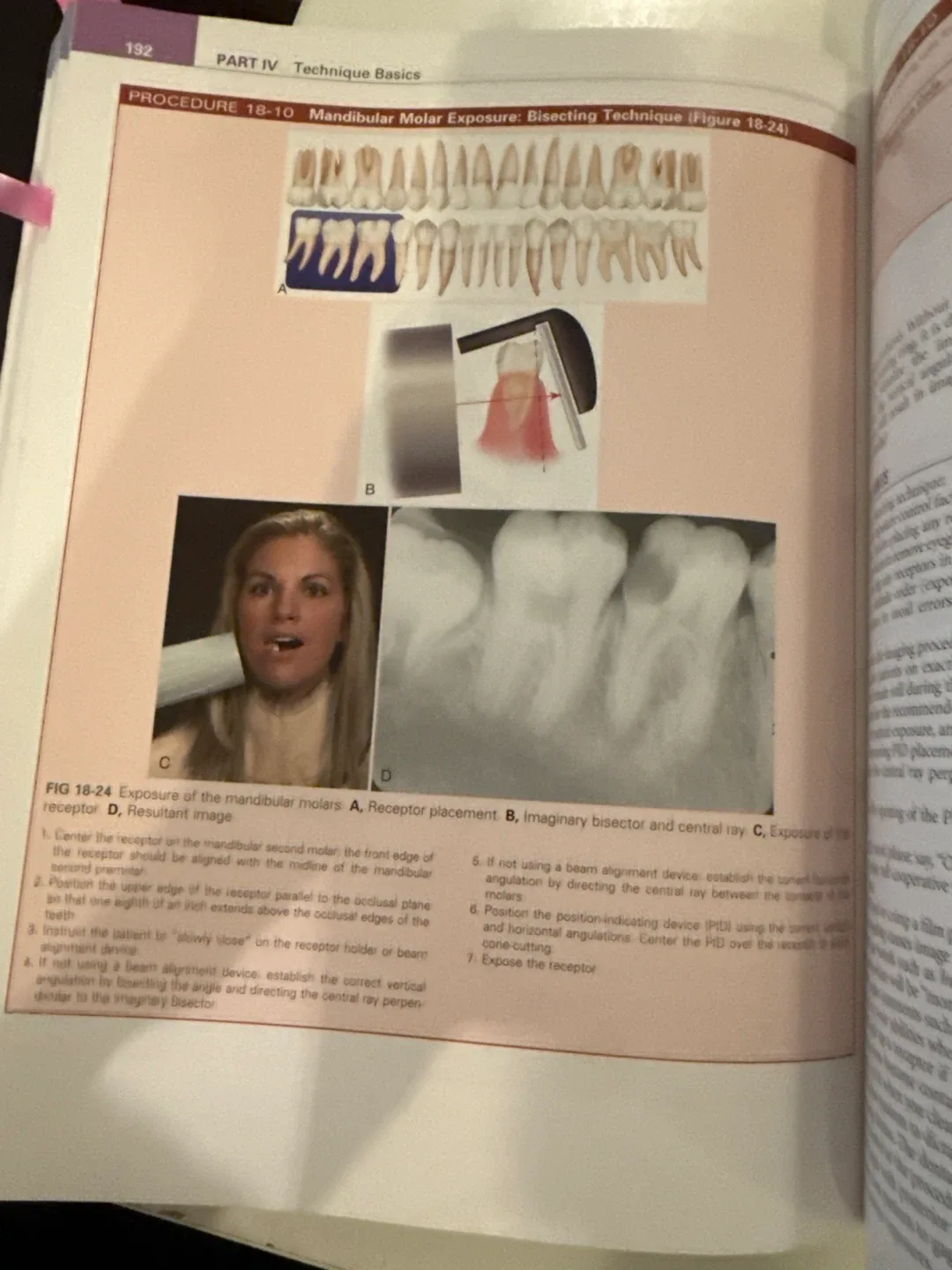 Dental Radiography: Principles & Techniques 5th Edition image indicator(4)