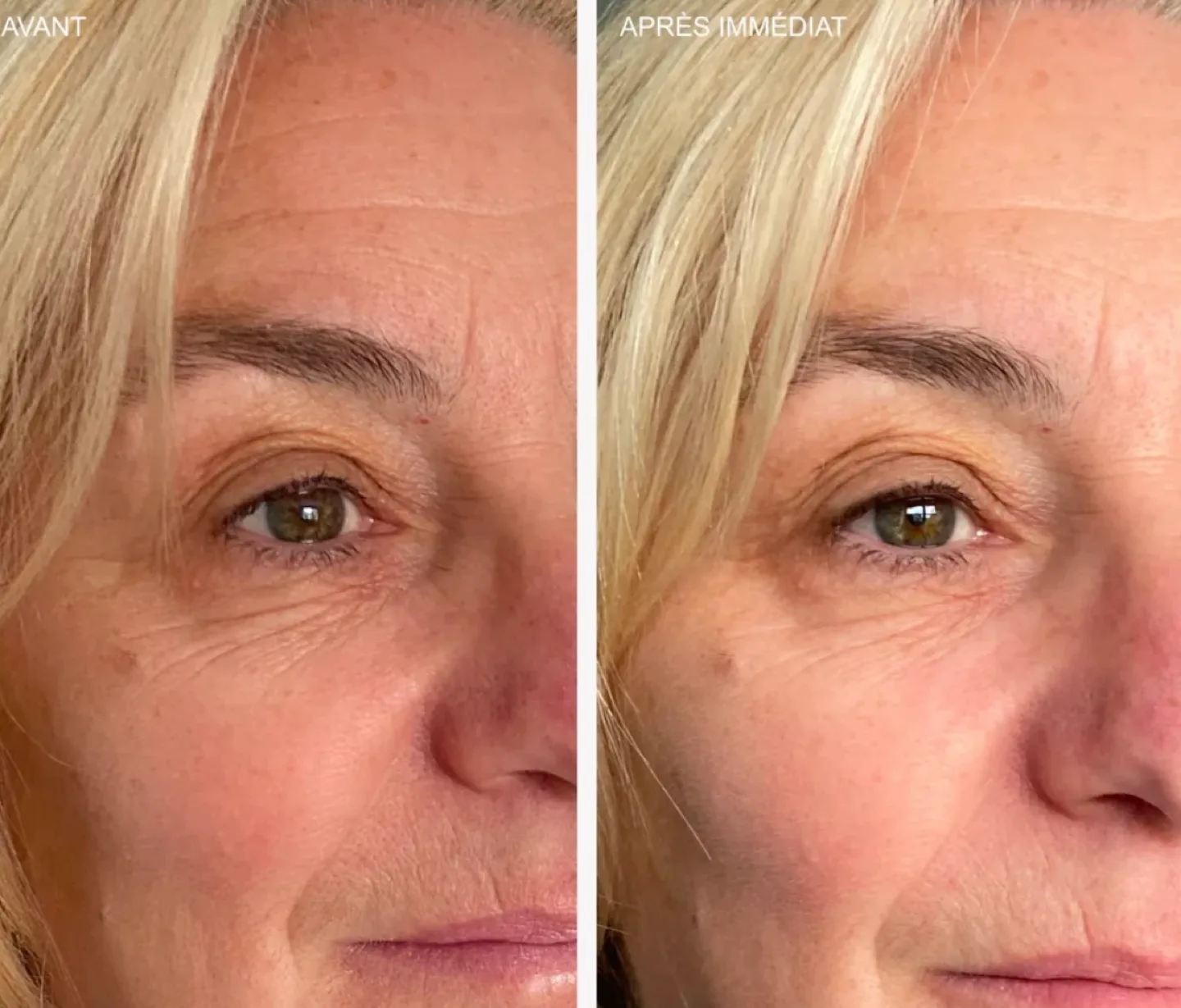 Omy Triple-Exfoliating Face Mask - 75 ml image indicator(3)