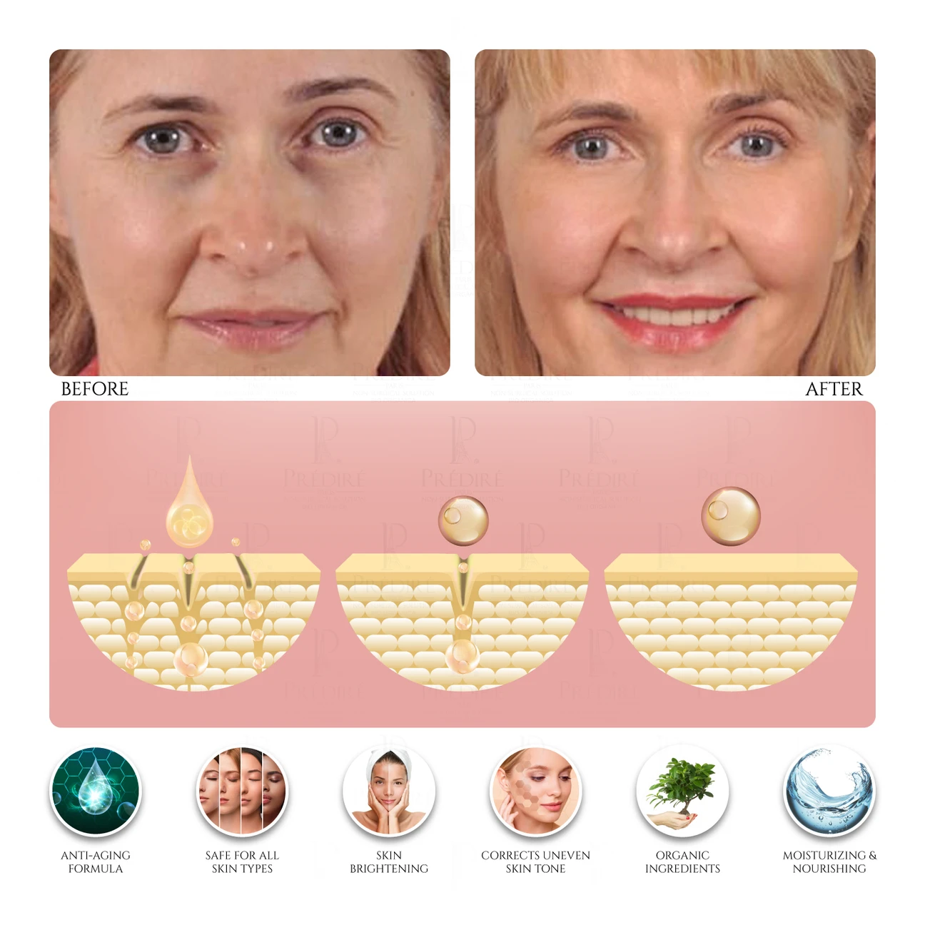 Predire Paris Caviar Hyaluronic Acid Collection - photo 2