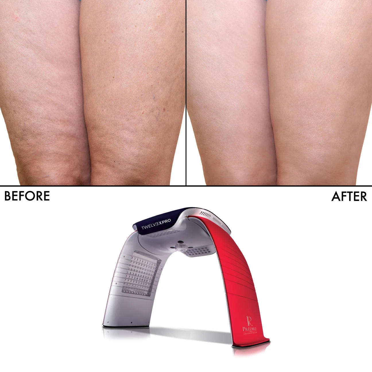 PRÉDIRE TWELV3XPRO LED Infrared Device - photo 3