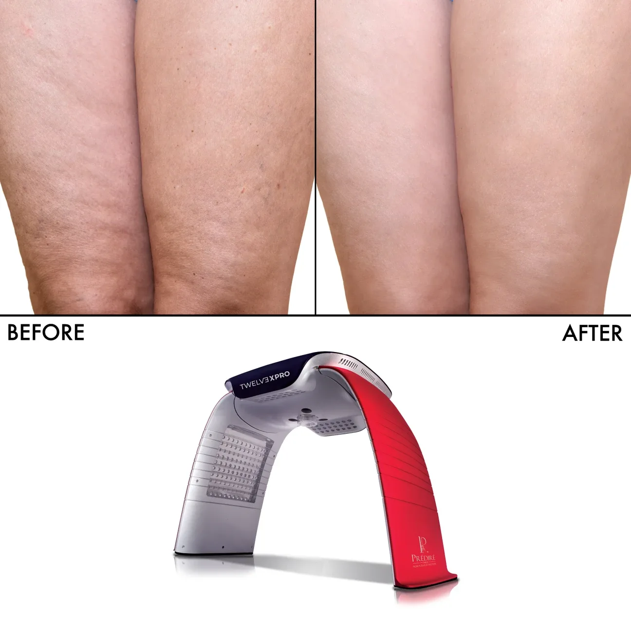 PR�ÉDIRE TWELV3XPRO LED Infrared Device image indicator(3)