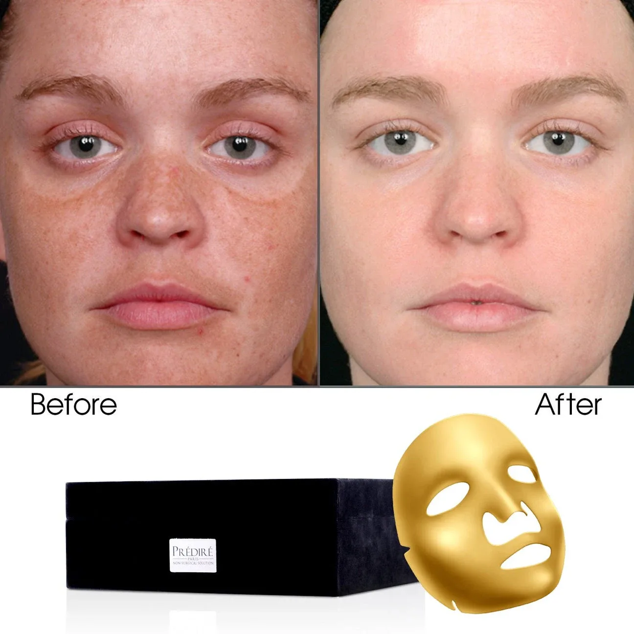 PREDIRE Paris 2 in 1 Prestige Gold Mask (16 pack) image indicator(2)