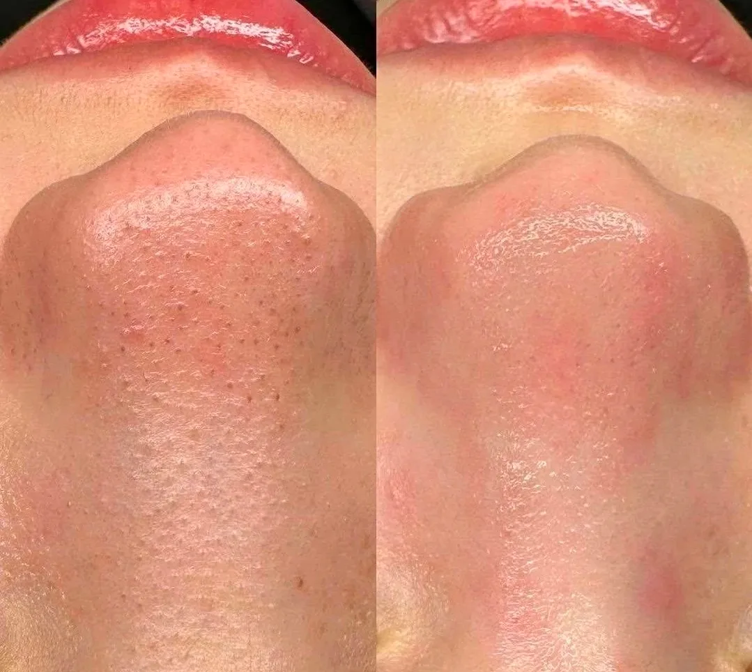 Beauty image indicator(2)