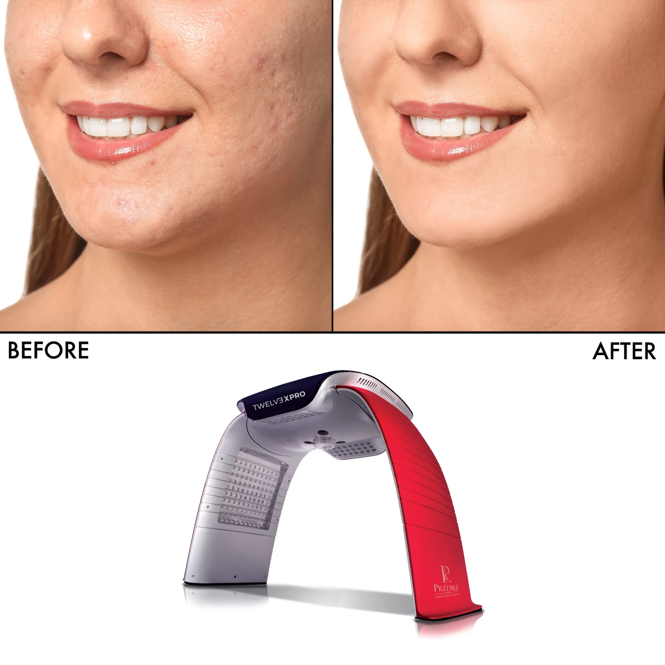 PRÉDIRE TWELV3XPRO LED Infrared Device - photo 2