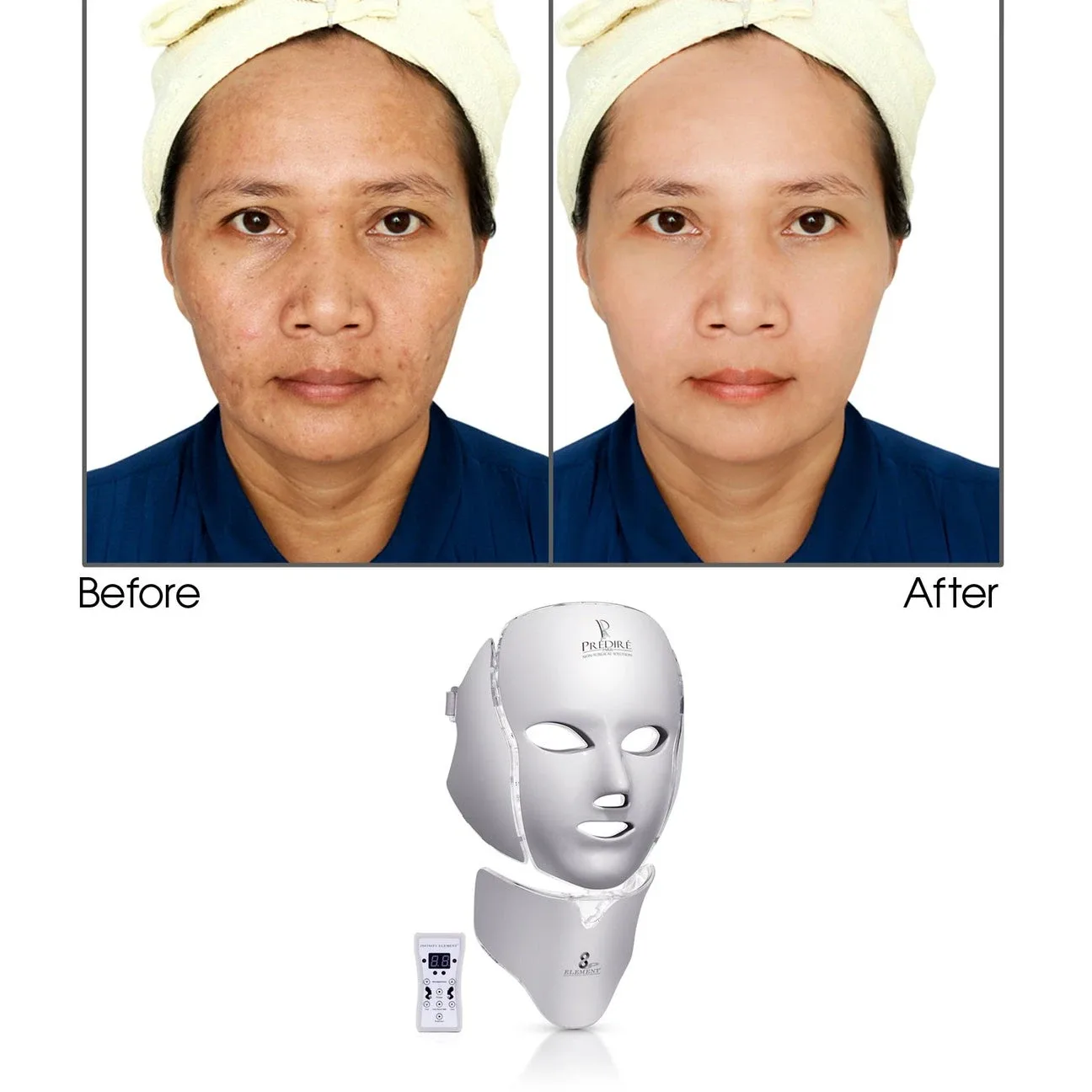 Prédiré Paris 8 Element LED Mask image indicator(3)