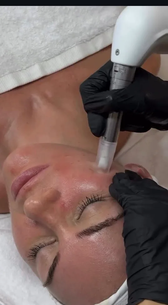 XCellarisPRO TWIST Device image indicator(2)