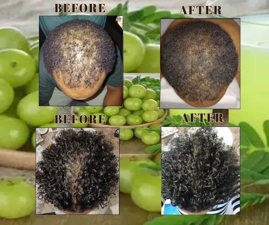 Starriel Butter & Oil Hair Care Set image indicator(4)