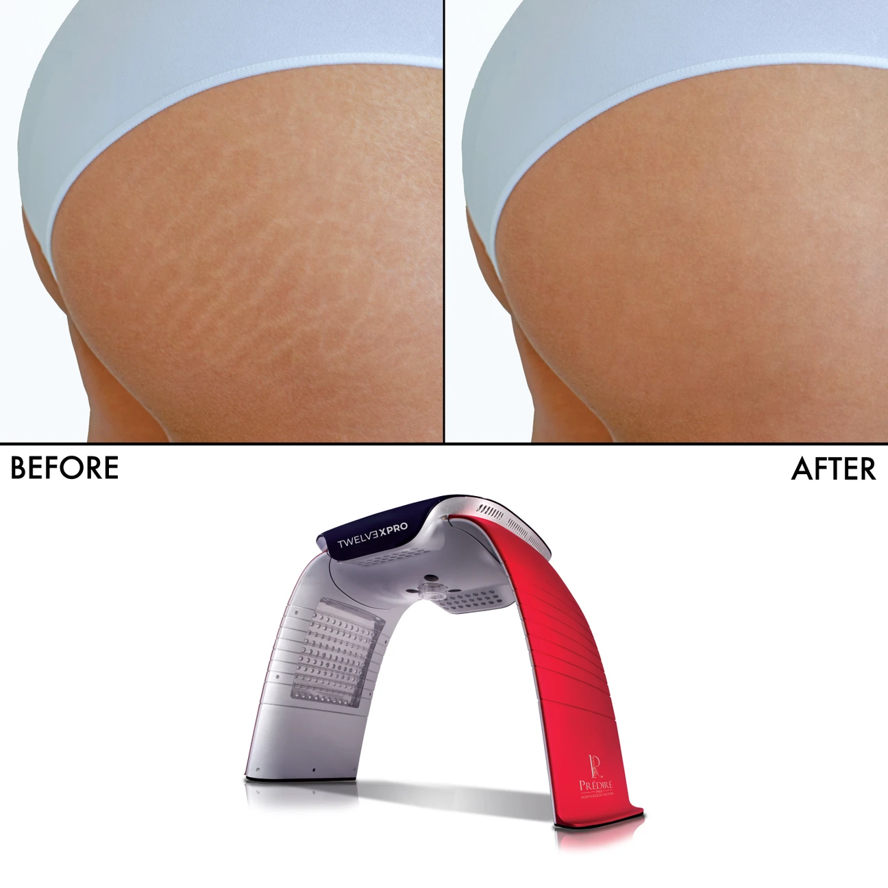 PRÉDIRE TWELV3XPRO LED Infrared Device - photo 4