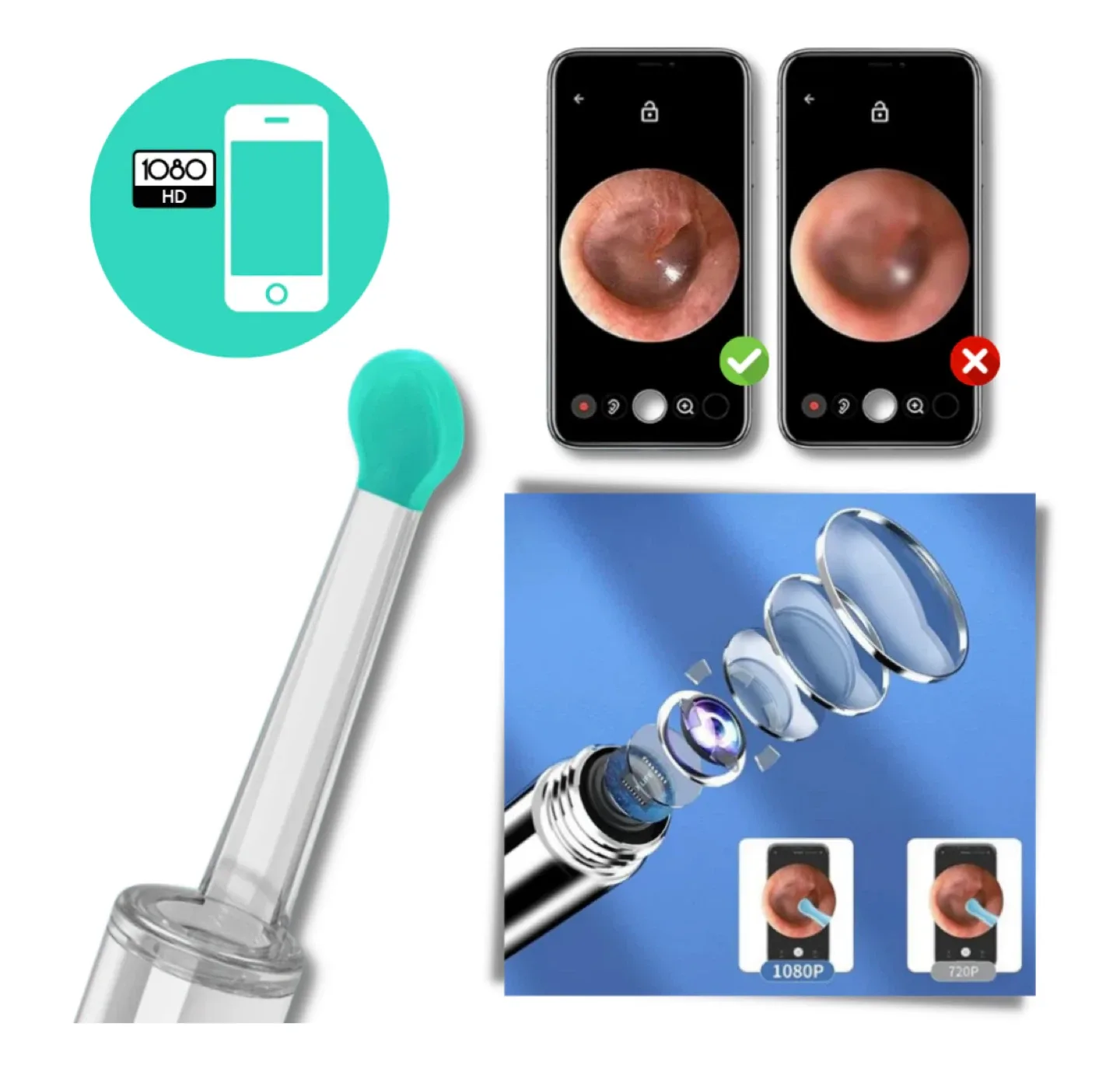 # Cleanout, 🌱 Brand new Smart Ear Wax Removal Camera