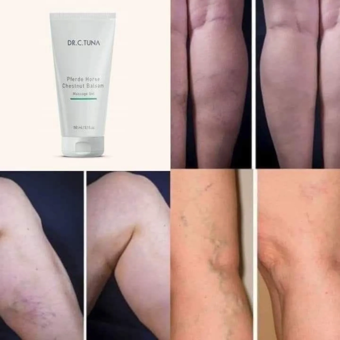 Dr. C. Tuna Plerde Horse Chestnut Balsam image indicator(2)