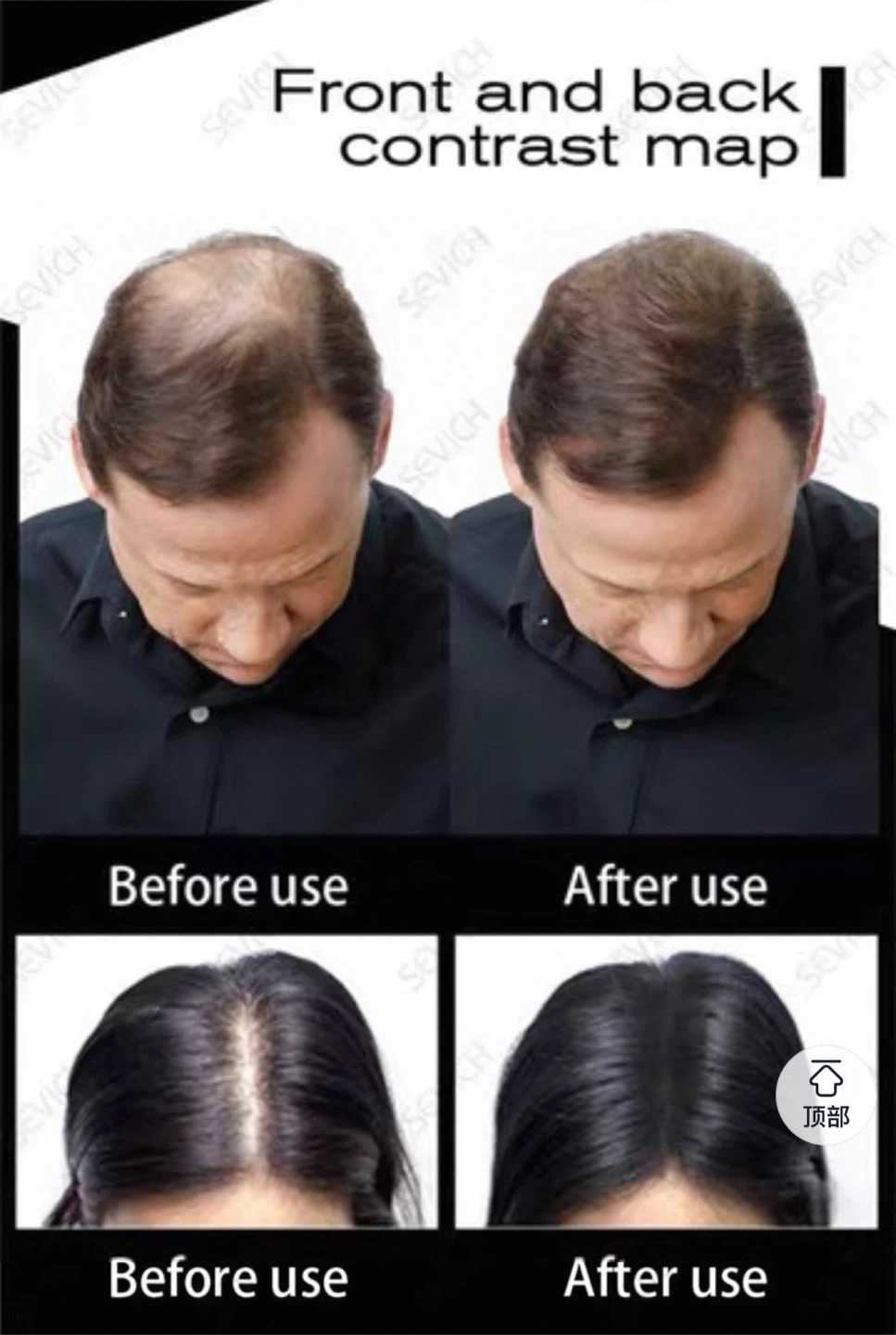 Sevich Black Hair Building Fibers - photo 2