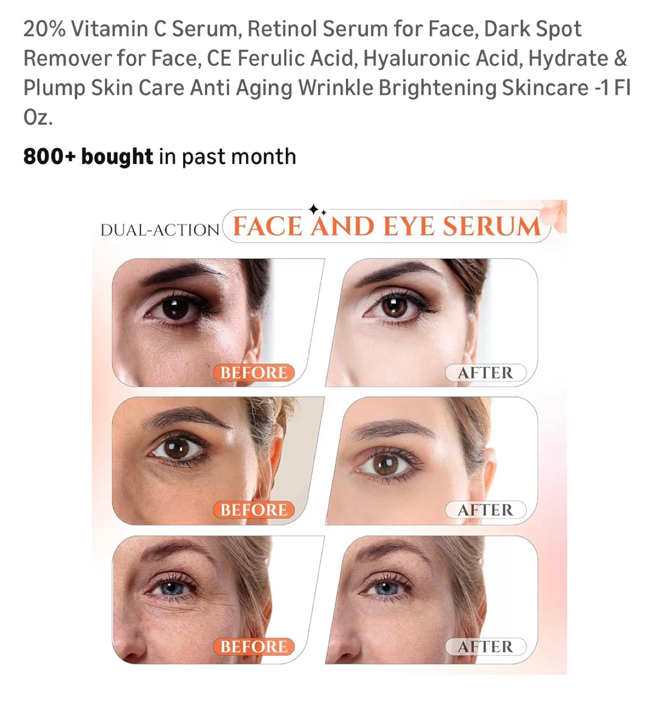 Brand New 20% Vitamin C Serum - photo 3