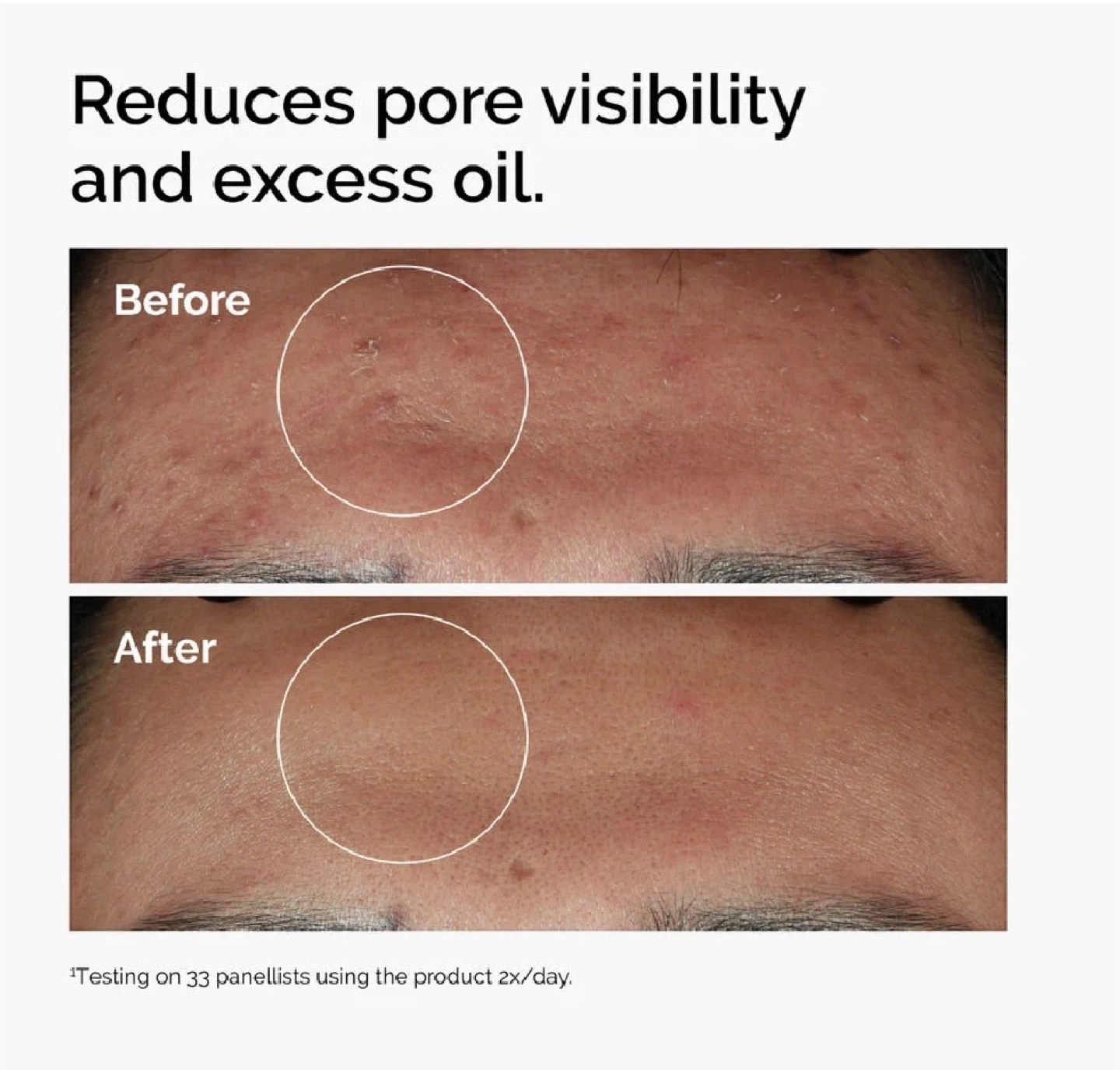 The Ordinary Niacinamide 10% + Zinc 1% Serum - photo 3