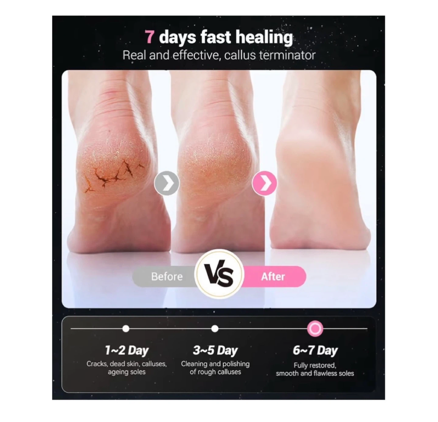 Brand new 5-in-1 Professional Electric Foot Callus Remover - photo 5