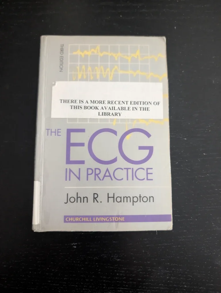 ECG in Practice