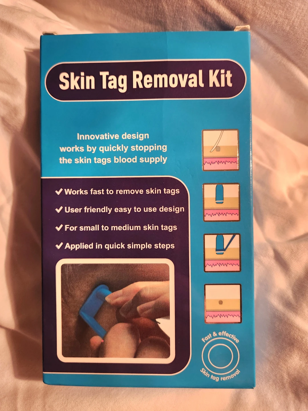 Skin Tag Removal Kit