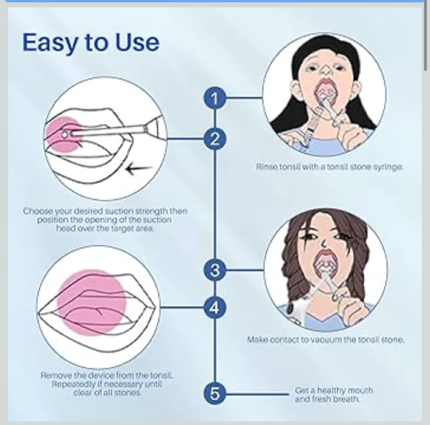 Tonsil Stone Remover Kit with Accessories - photo 2