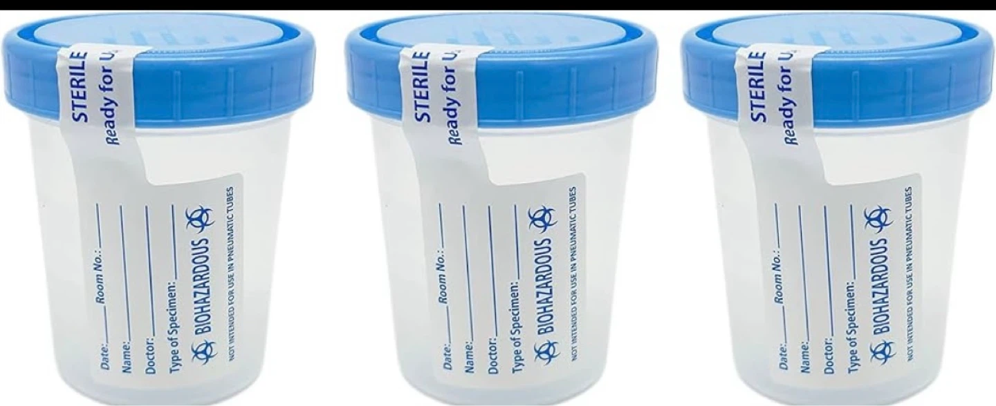 Urine specimen container 120ml - photo 2