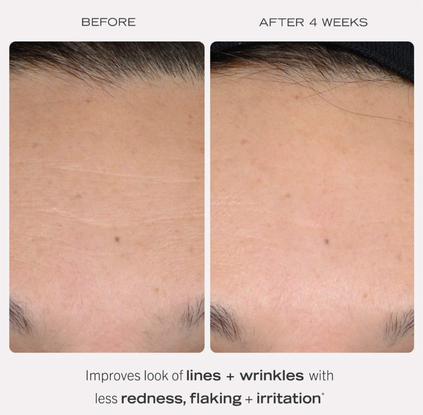 First Aid Beauty 0.3% Retinol Complex Serum - photo 2