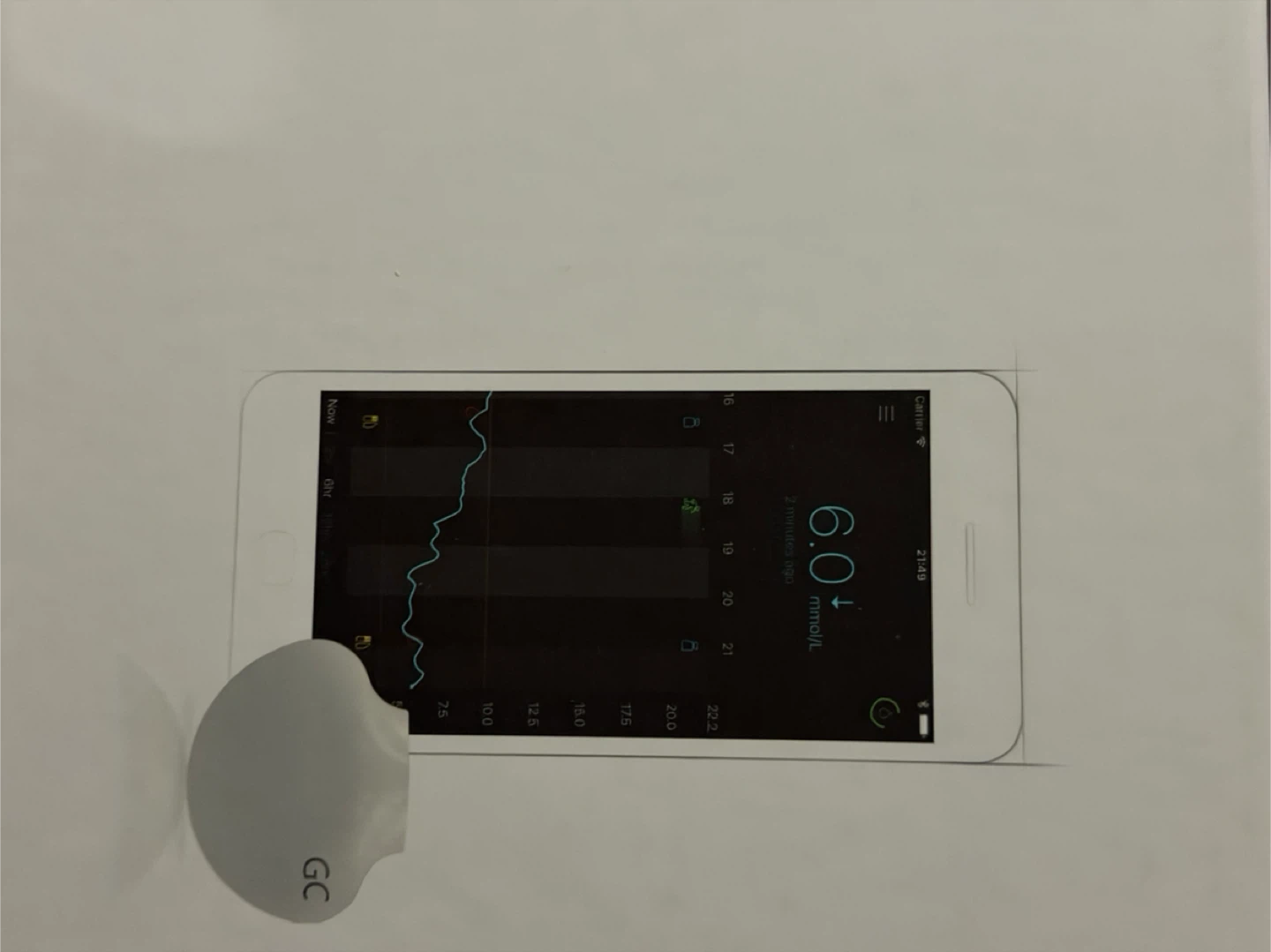 Medtronic Guardian Sensor (3) - photo 4