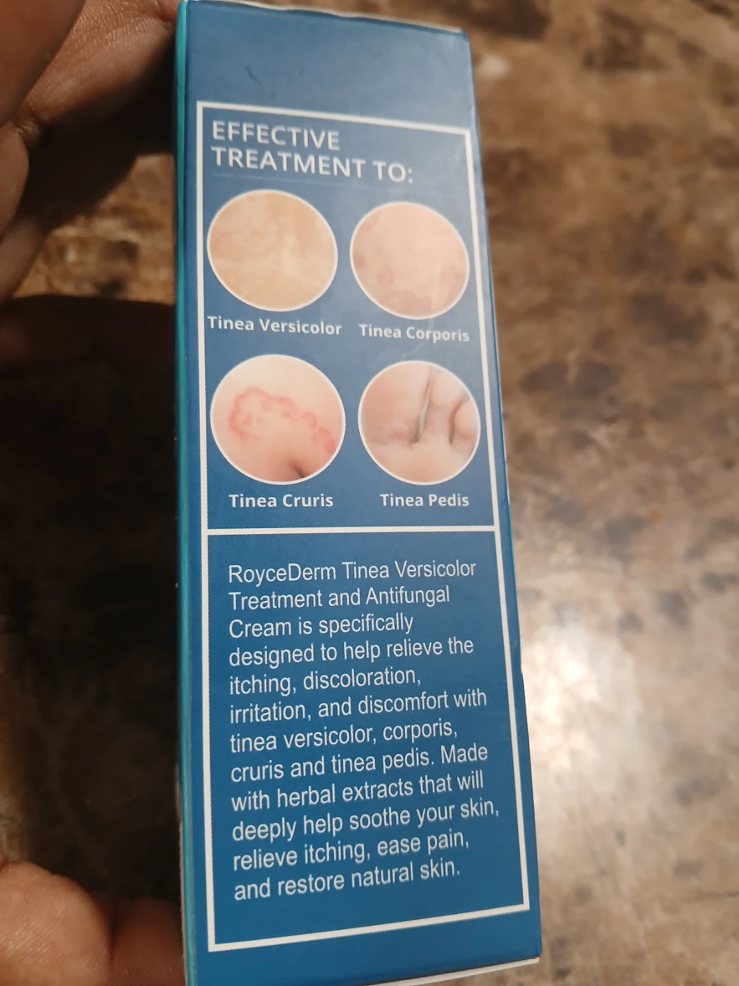 RoyceDerm Tinea Treatment Cream, 2 oz 11/2026 - photo 2