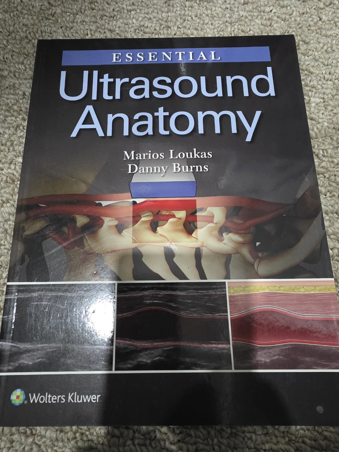 Essential Ultrasound Anatomy Book