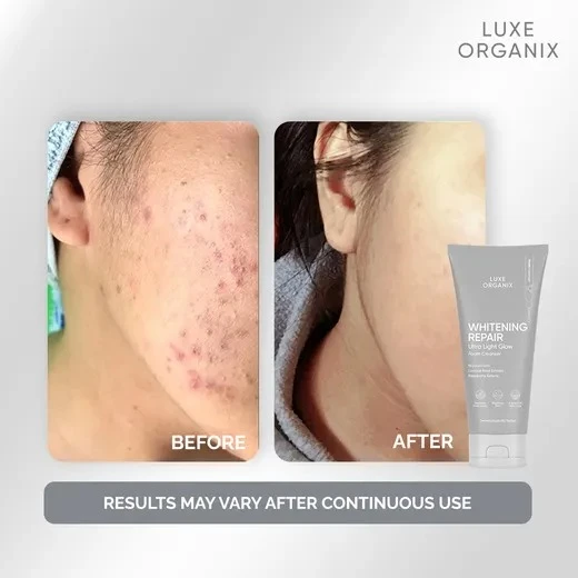 LUXE ORGANIX Whitening Repair Ultra Light - photo 5