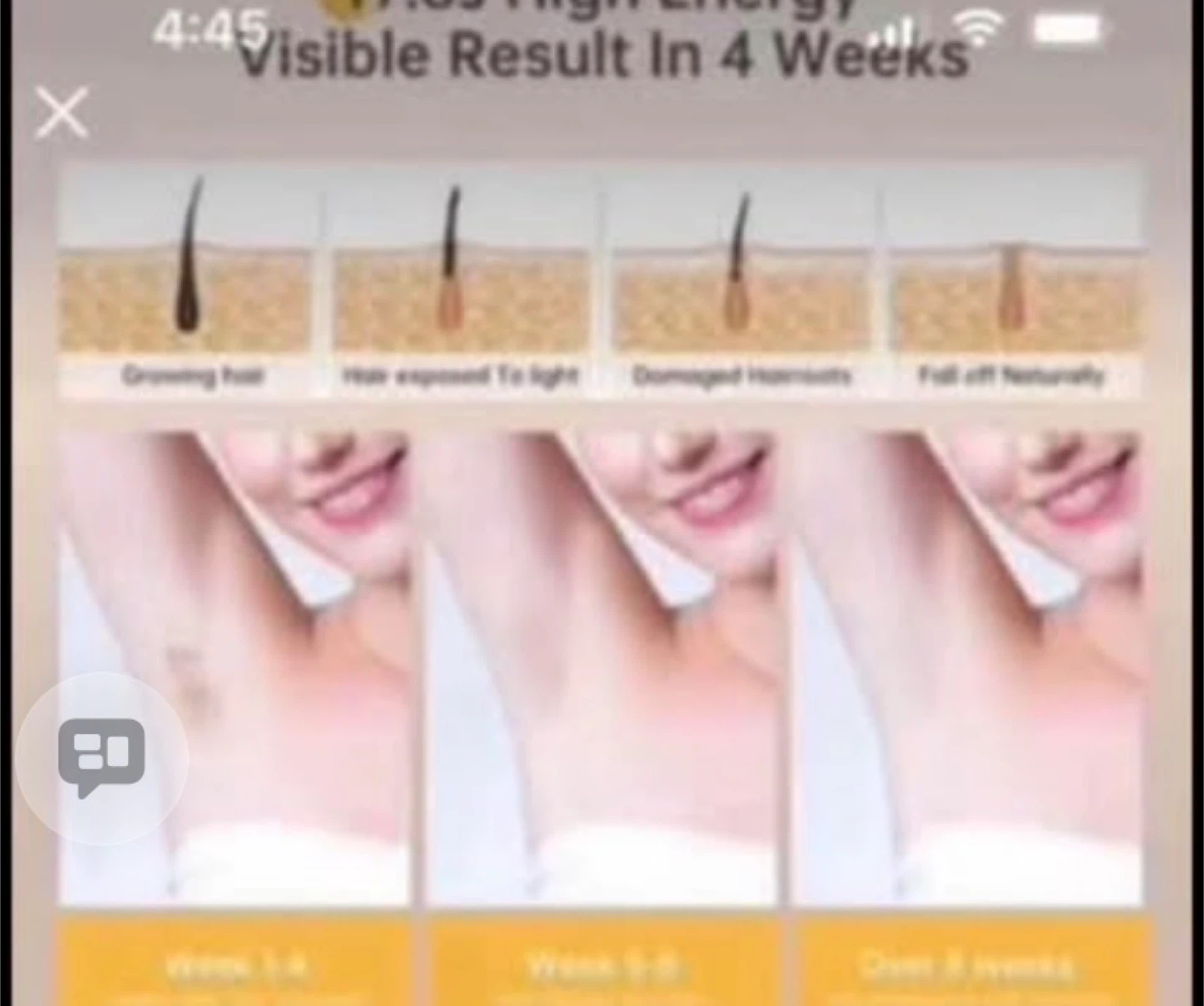 Hair Removal Device - Auto/Manual Modes - photo 5