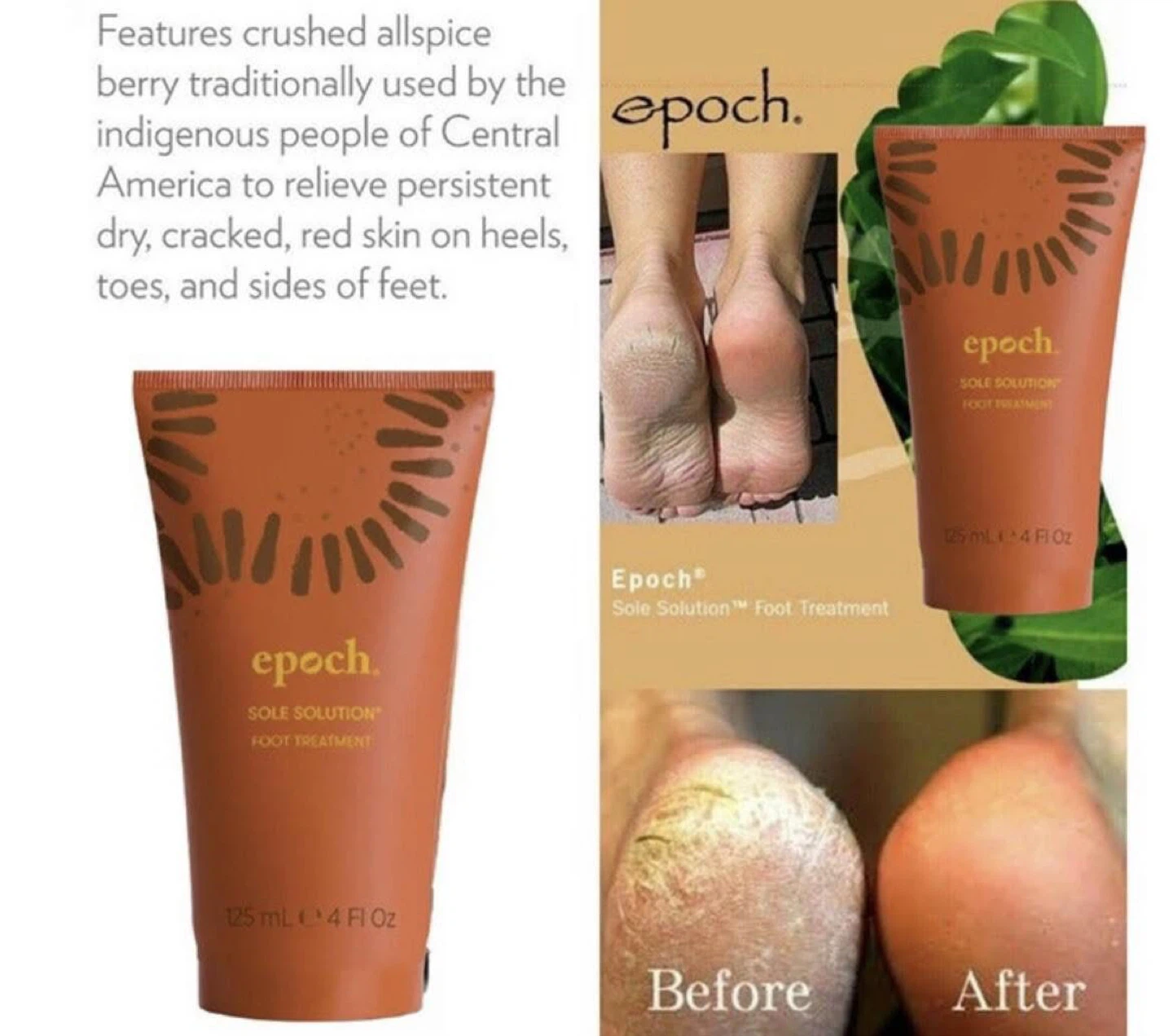 Epoch Sole Solution Foot Treatment 125 mL
